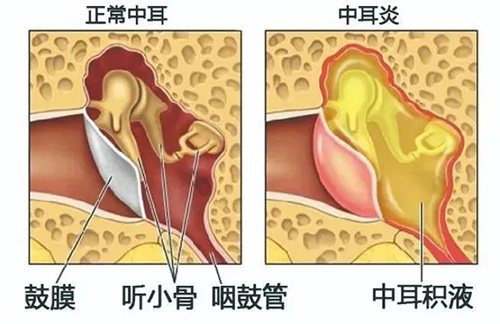 一年一度愛耳日，今年關(guān)愛不一般