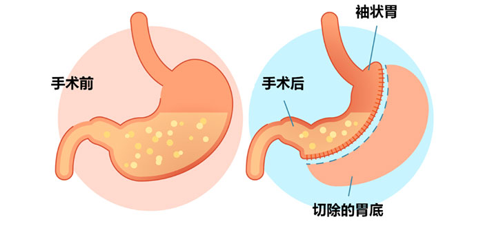 【專家指導(dǎo) 科學(xué)減重】我院開展減重知識(shí)培訓(xùn)活動(dòng)