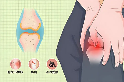 膝關(guān)節(jié)假體置換術(shù)：重啟生命律動，邁向美好未來