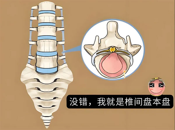 【惠民科普】腰間盤的“變形記”——告別“突出”，迎接健康