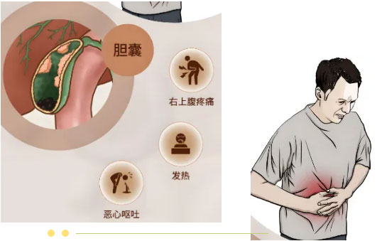 【惠民科普】腹脹、惡心、嘔吐......這種癥狀不一定是胃病，還可能是結(jié)石性膽囊炎！
